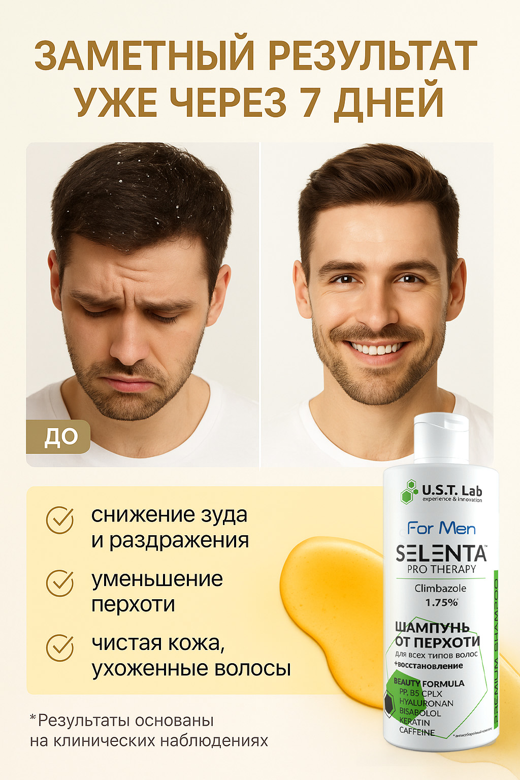 Шампунь от перхоти