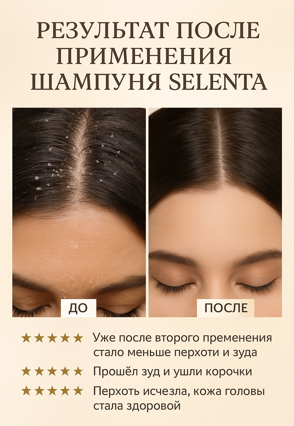 Шампунь от перхоти селента