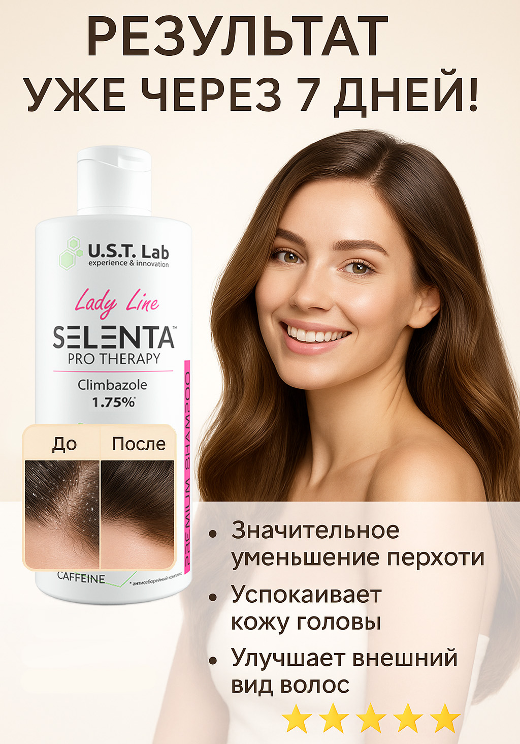 Шампунь от перхоти селента